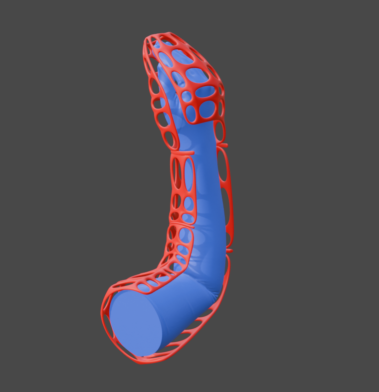 Arm Cast V2 Alternate